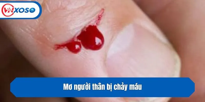 Mơ người thân bị chảy máu